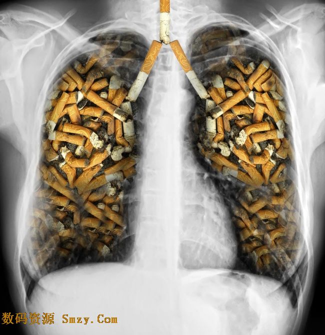吸烟者的肺图片|吸烟者的肺满是烟头高清图片