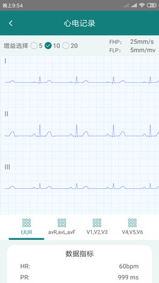 及时智能心电检测无线蓝牙版 截图2