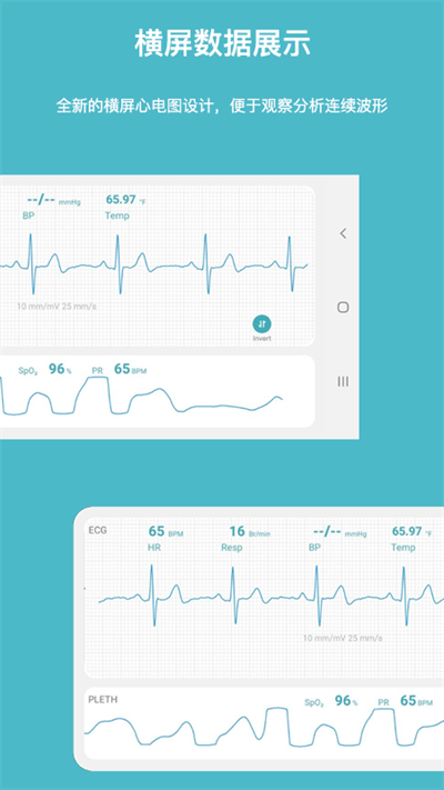 多体征监护仪app 截图1