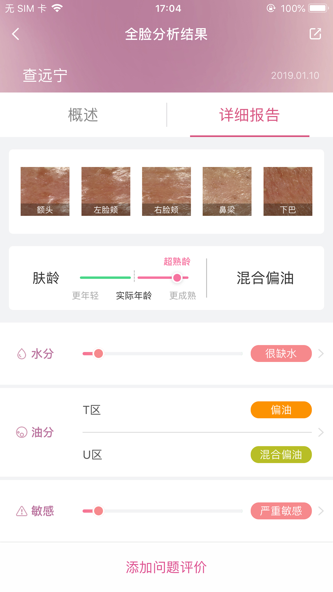 肌肤分析仪app 截图1