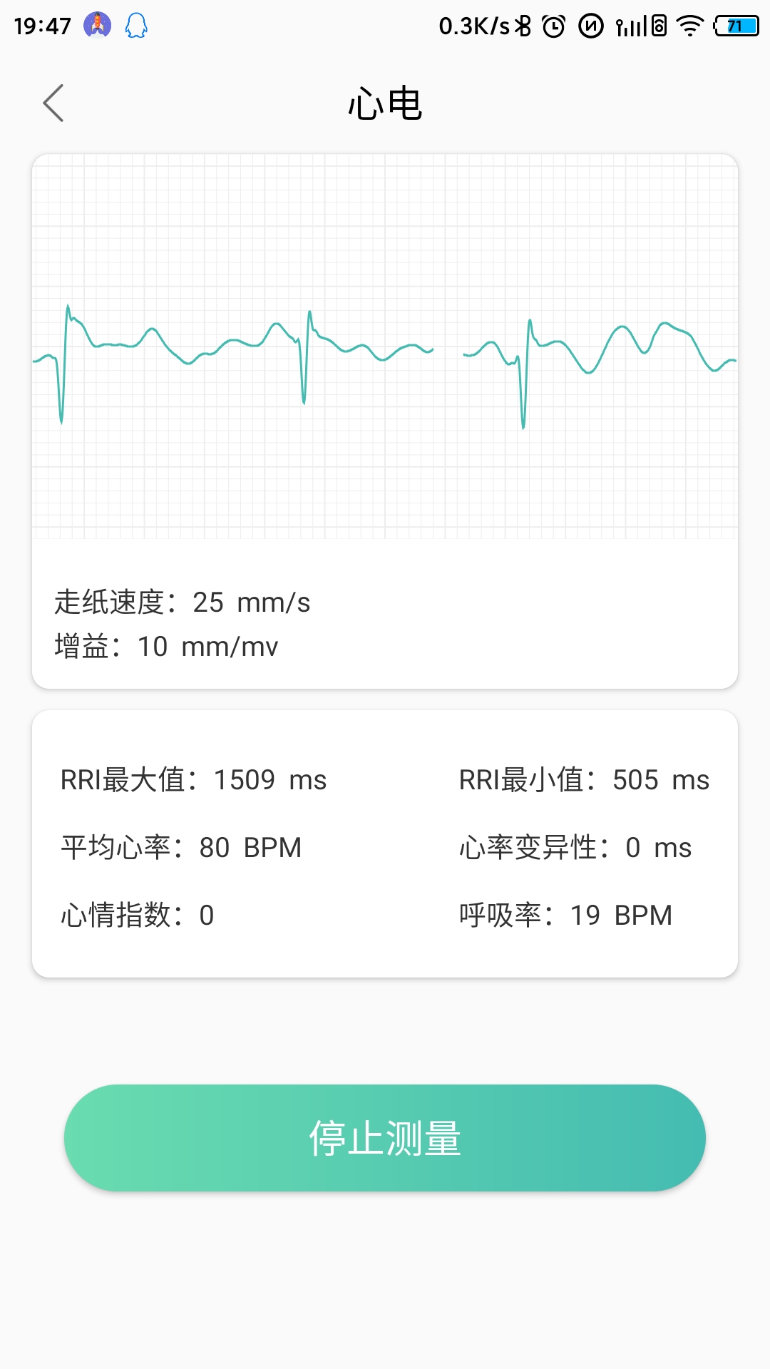 MinttiVision智能健康监护仪 1.0.5 截图1