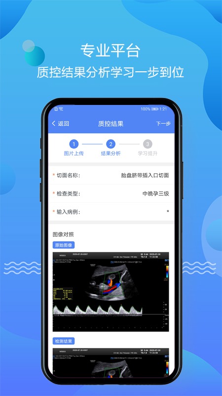 超声智库app 截图1