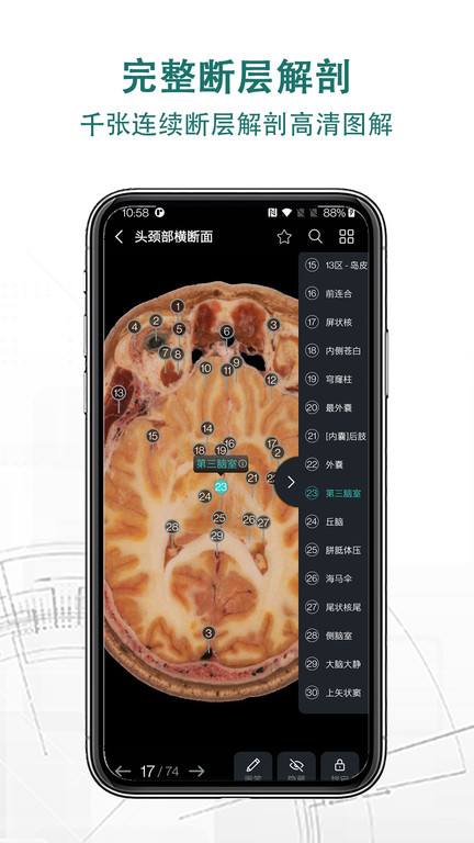 掌上3d解剖 截图1