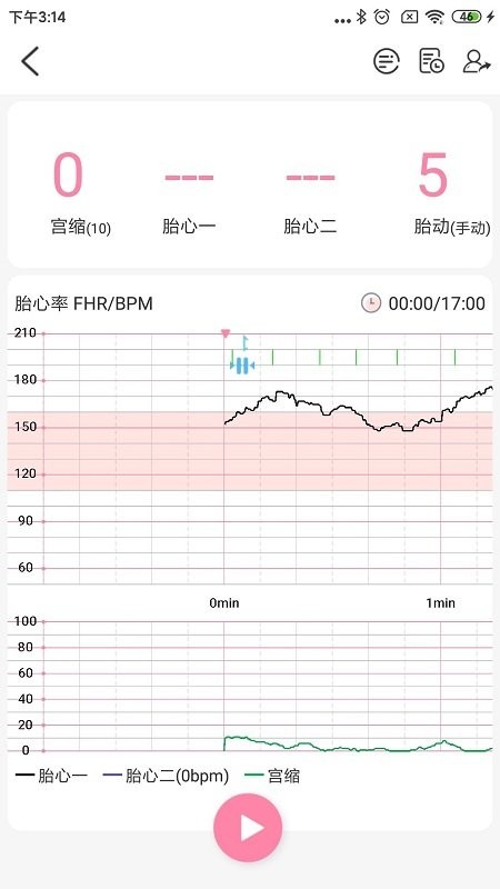 十月宝贝胎心监护医生 截图1